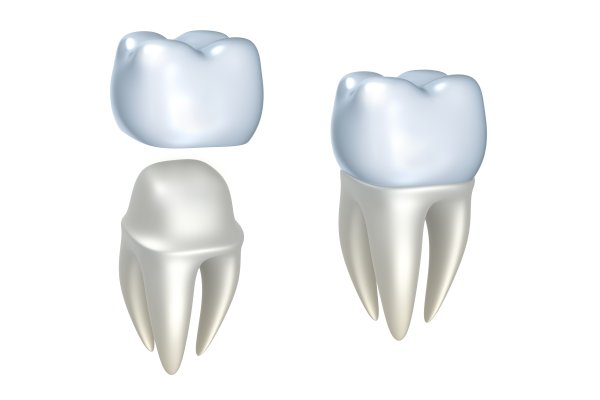 Are Dental Crowns And Dental Caps The Same?